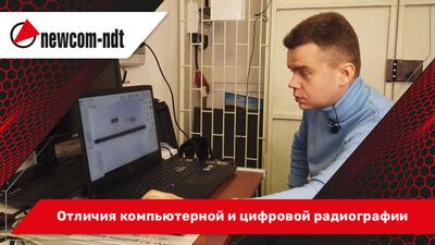 Отличия компьютерной и цифровой радиографии