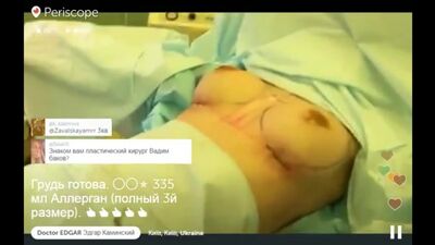 Доктор Эдгар презентует грудь третьего размера