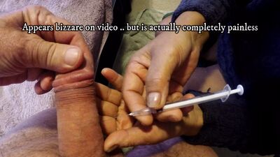 Alprostadil укол пениса женой и спермой