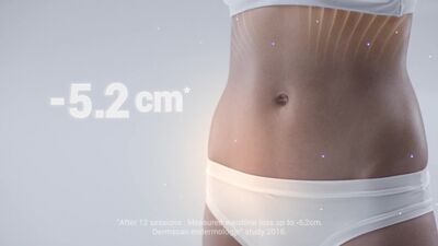 LPG Alliance (LPG Альянс) в Петербурге в Эстетик Клубе