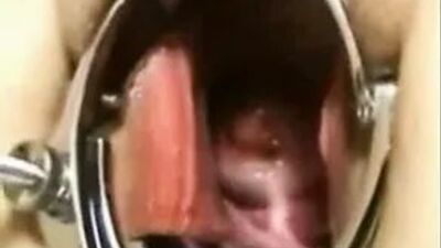 Elmer жена - анальный фистинг в две руки объектам