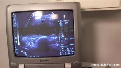 Зарезанная рыжая сосет и трахается в кабинете врача