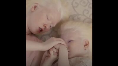 Сестры с необычной внешностью - Альбиносы